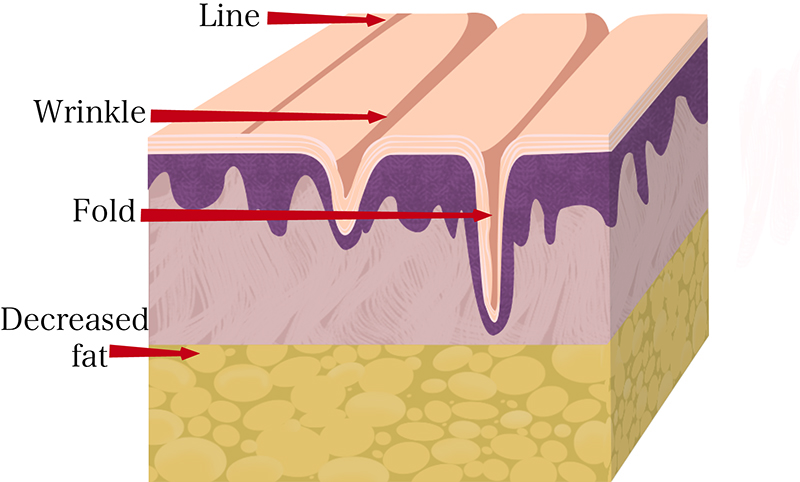 the procedure: rhinoplasty for the aging nose photo